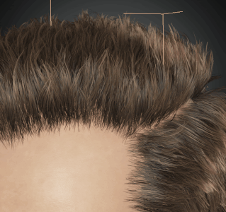 Cc34 hair scalp overfill right.gif