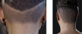 Cc34 hair exposed scalp new.png